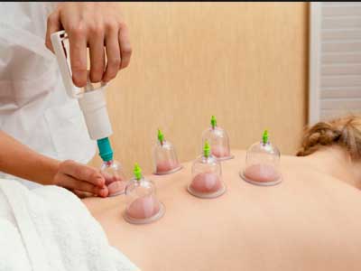 Bekam Massage